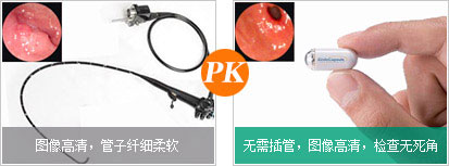 OMOM膠囊內鏡優勢