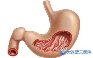 大連胃腸醫(yī)院胃出血如何治療?